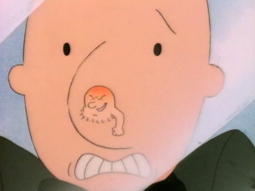 Doug's Huge Zit